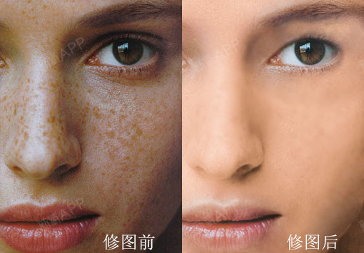 斑斑点点不能留!