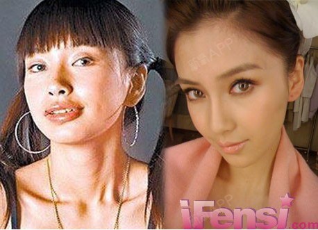 郑爽姚笛整形后照片曝光盘点女星整容前后对比照(图)近日,郑爽整容的