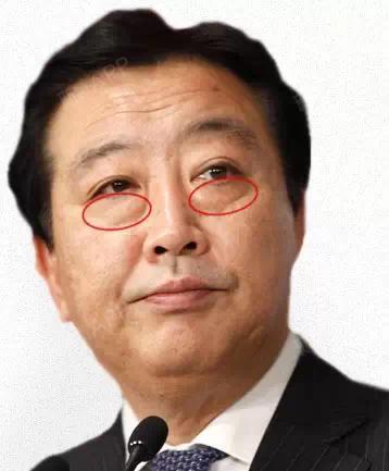 眼袋,卧蚕,泪沟,黑眼圈 还在傻傻分不清?