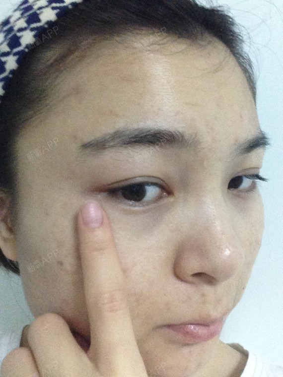 孙强整形美容（整形美容专家在线咨询）《孙强医疗美容》
